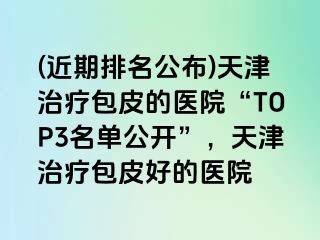 (近期排名公布)天津治疗包皮的医院“TOP3名单公开”，天津治疗包皮好的医院