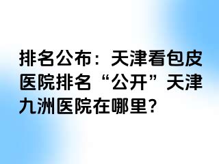 排名公布：天津看包皮医院排名“公开”天津九洲医院在哪里?