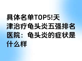 具体名单TOP5!天津治疗龟头炎五强排名医院：龟头炎的症状是什么样