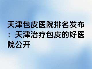 天津包皮医院排名发布：天津治疗包皮的好医院公开